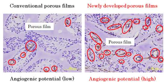 Development of growth factor-free tissue adhesive porous films capable of promoting angiogenesis