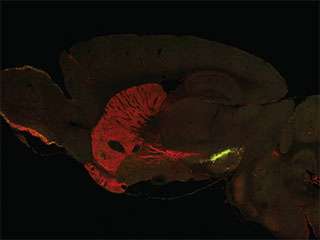 New research sheds light on the molecular origins of Parkinson's disease