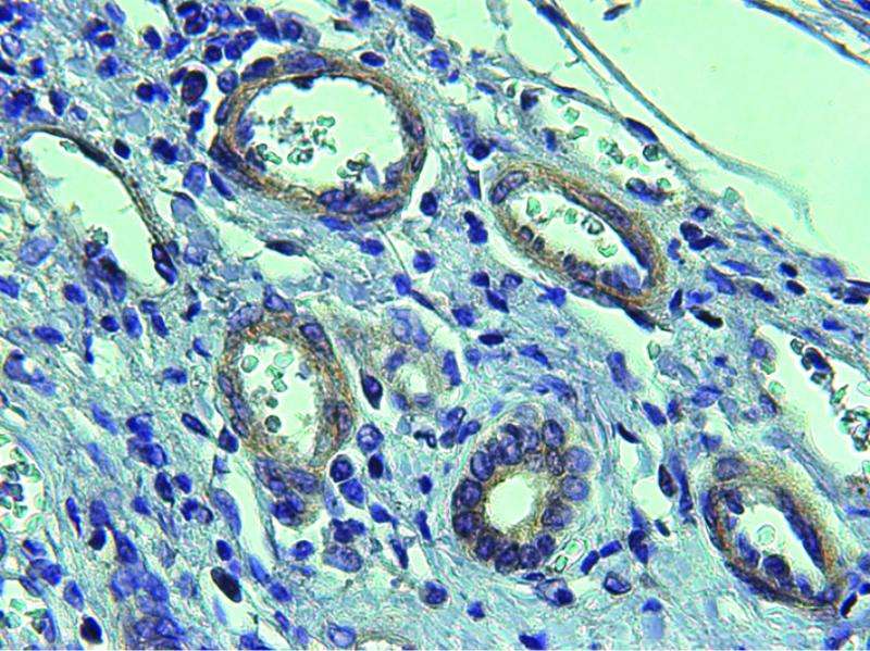Scientists in Barcelona discover a potential treatment for cirrhosis