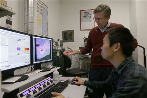 Researchers grow brain parts to study development, disease
