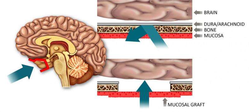 Researchers develop drug delivery technique to bypass blood-brain barrier