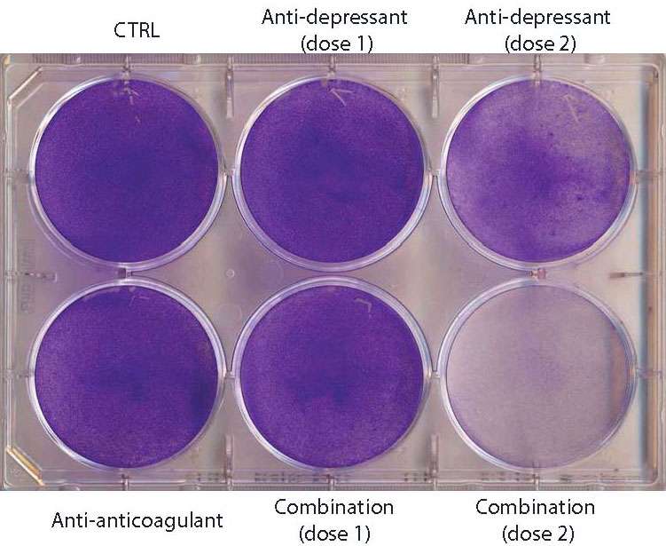 Antidepressants plus blood thinners cause brain cancer cells to eat themselves in mice