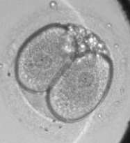 Discovery could improve in vitro fertilization success rates for women around the world