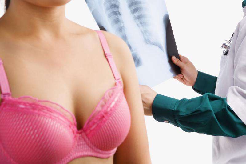 Do Latina women have lower risk of developing breast cancer than Americans?