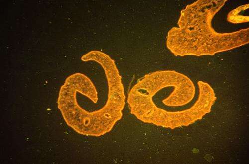Genetic discovery may offer new avenue of attack against schistosomiasis