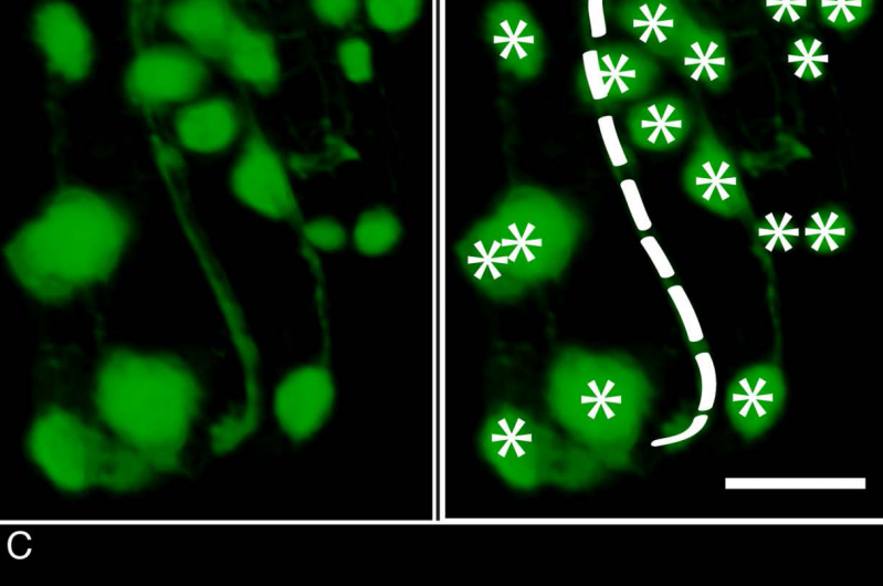 How is a developing brain assembled? 3-D software tracks worm embryo’s brain development