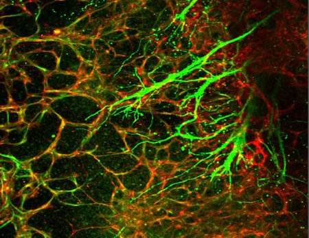 Human stem cell model reveals molecular cues critical to neurovascular unit formation