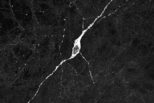Scientists produce hypothalamic neurons, which can help target a range of conditions
