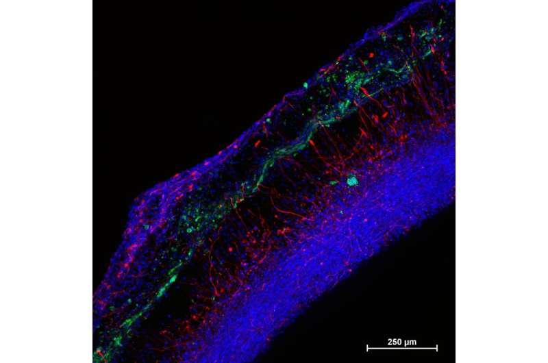 Stem cell-derived 'organoids' help predict neural toxicity