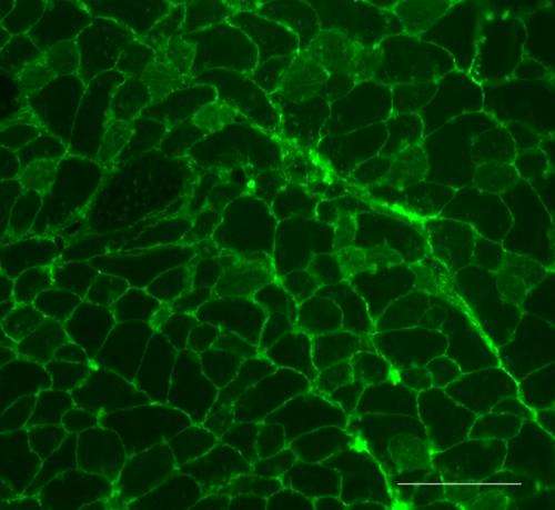 Study disputes previous theories on loss of muscle stem cells and aging