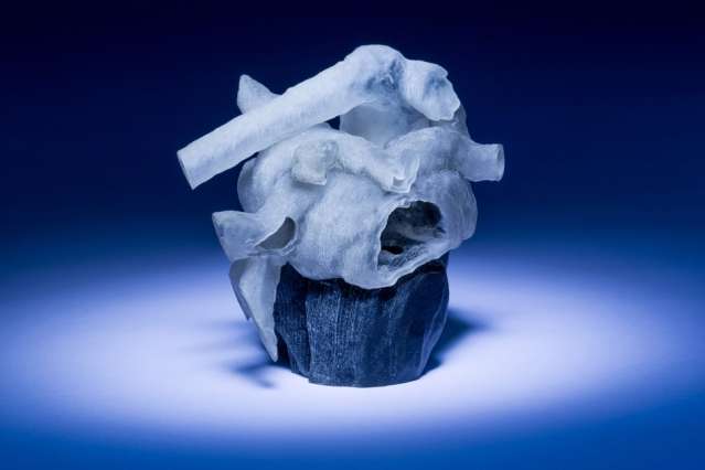 System can convert MRI heart scans into 3D-printed, physical models in a few hours