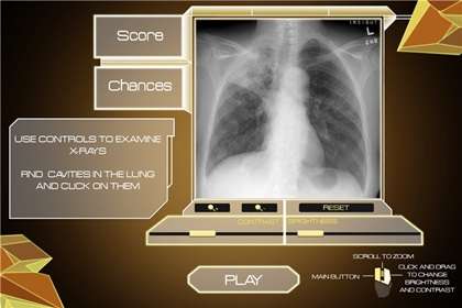 Tuberculosis video game battles world’s oldest disease