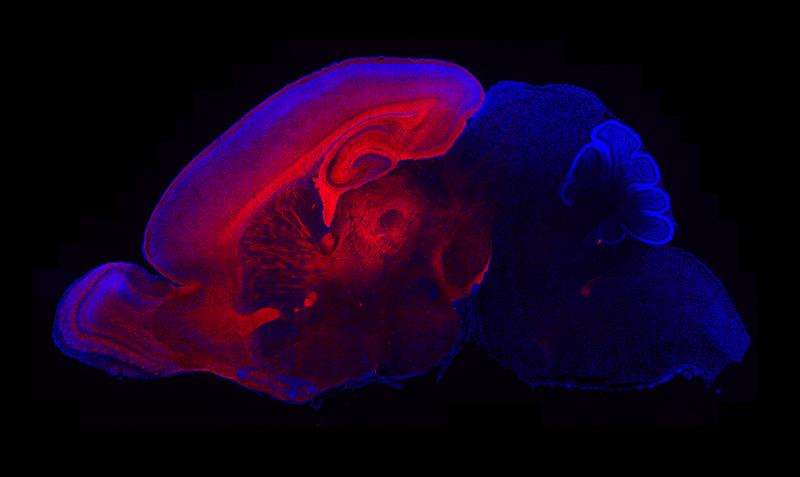 overproduction of neurons in brain development