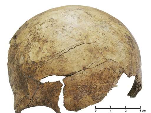 Scientists find evidence of prehistoric massacre in Europe