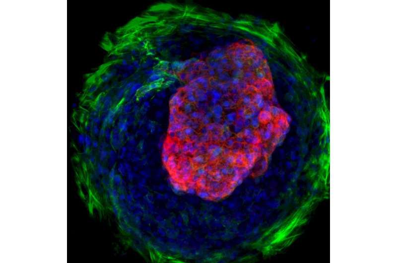 Researchers create model of early human heart development from stem cells