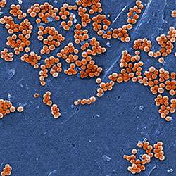 Combo of 3 antibiotics can kill deadly staph infections