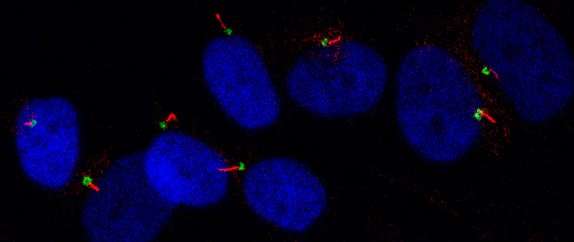 Manipulating the antennae on cells promises new treatments for osteoarthritis