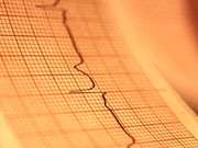 Many americans may experience 'Silent' heart attack
