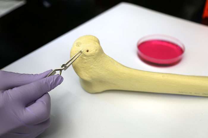 New material could advance bone-grafting treatments for cancer patients
