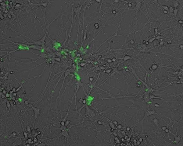 Study shows that certain herpes viruses can infect human neurons