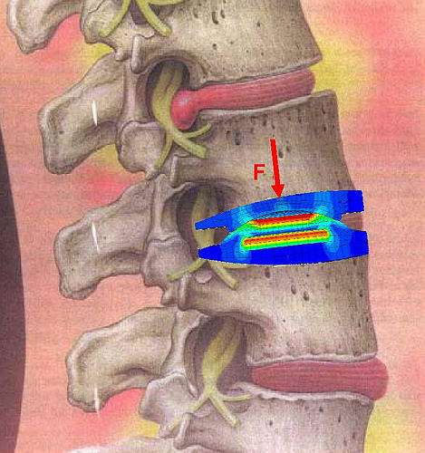 Researchers seek to decode the mechanics of the lower vertebrae