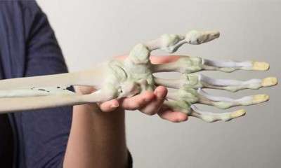 3D printed anatomy kit is now available