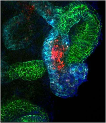 Investigators create complex kidney structures from human stem cells derived from adults