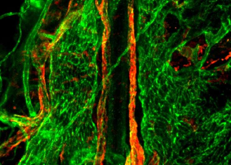 Unraveling the link between brain and lymphatic system
