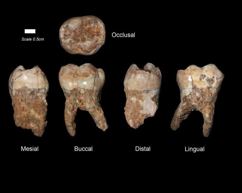 400,000-year-old dental tartar provides earliest evidence of manmade pollution
