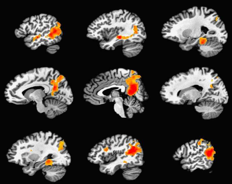 研究揭示了大脑产生持久记忆的机制