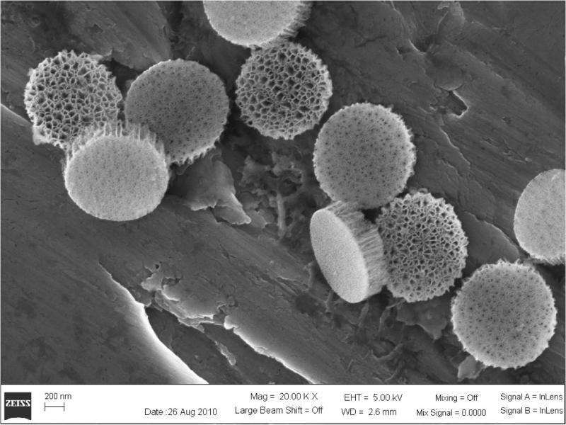 Breast cancer vaccines may work better with silicon microparticles