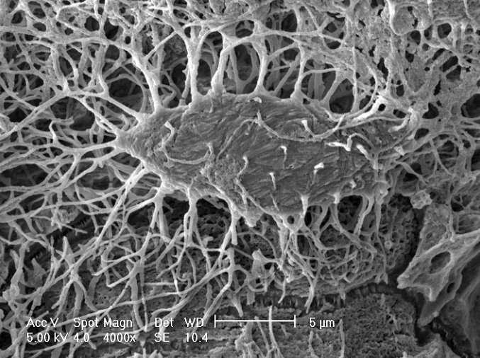 Scientists make no bones about first study of osteocyte cultures on Space Station