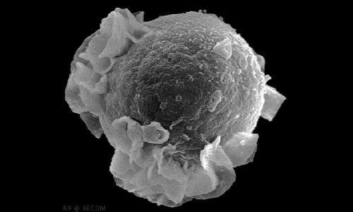 Study reveals how a cancer-causing virus blocks human immune response