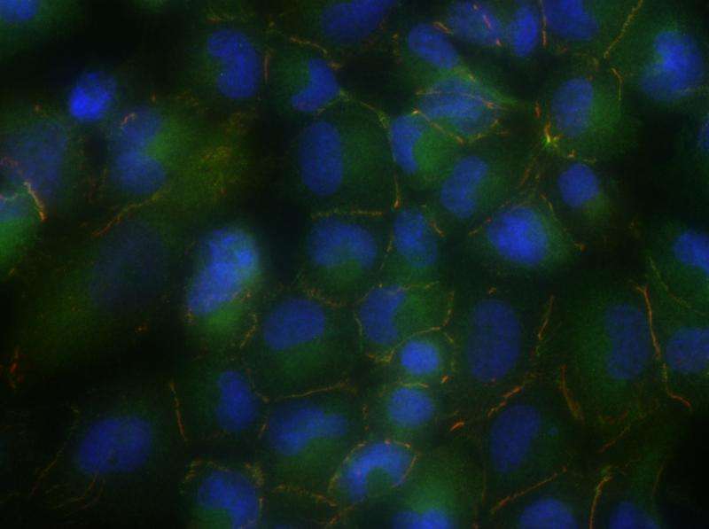 Researchers discover an inactive tumor suppressor gene in lung cancer