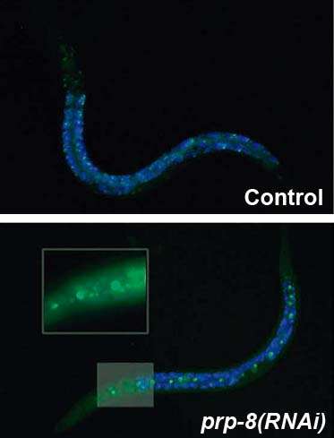 Researchers create a worm model to investigate a rare subtype of blindness