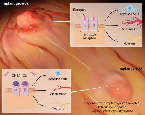 New drug compounds show promise against endometriosis