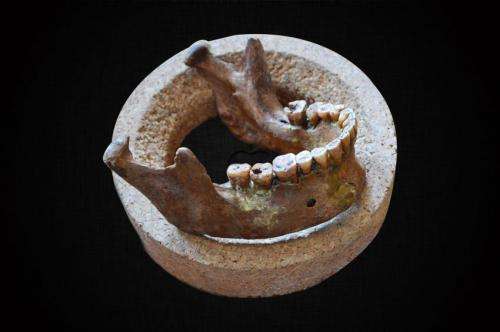 Malocclusion and dental crowding arose 12,000 years ago with earliest farmers
