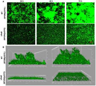 Researchers identify protein that allows Bordetella pertussis to form a protective biofilm