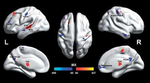 Autistic and non-autistic brain differences isolated for first time