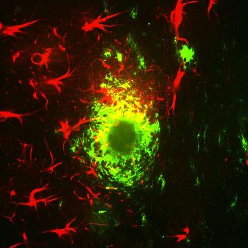 In Alzheimer's mice, memory restored with cancer drug