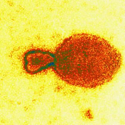 World–first human Hendra virus clinical trials begin