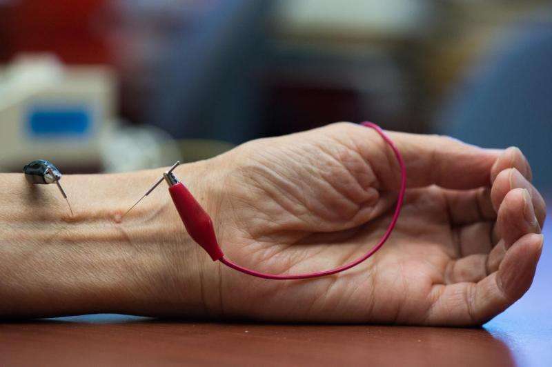 Hypertensive patients benefit from acupuncture treatments, study finds