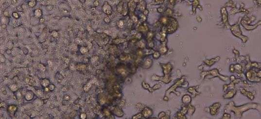 Next-generation genomic tests ID brain-eating amoeba