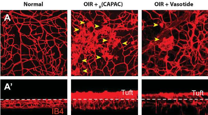 New drug candidate is promising therapeutic option for angiogenic retinal diseases