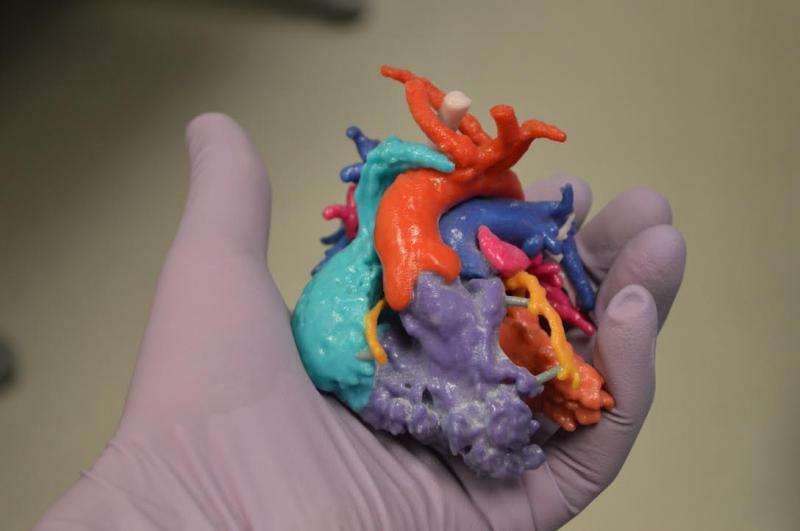 3-D image may provide better size match for child heart transplants