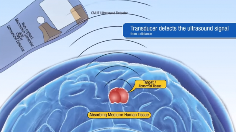New "tricorder" technology might be able to "hear" tumors growing