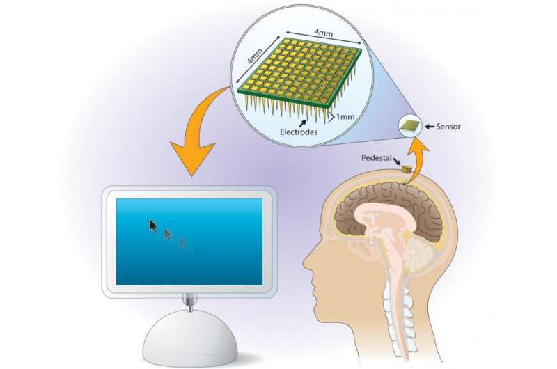 Self-calibration enhances BrainGate ease, reliability
