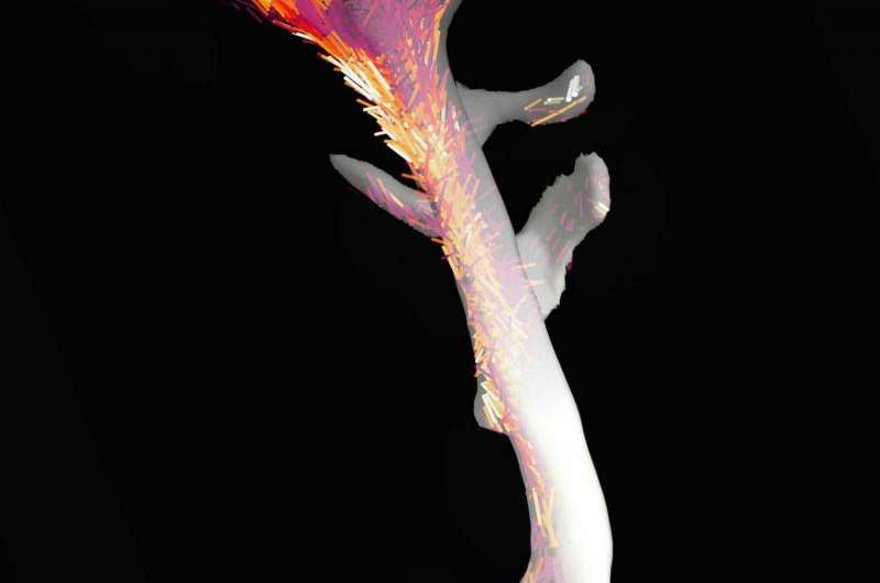 3D nanostructure of a bone made visible