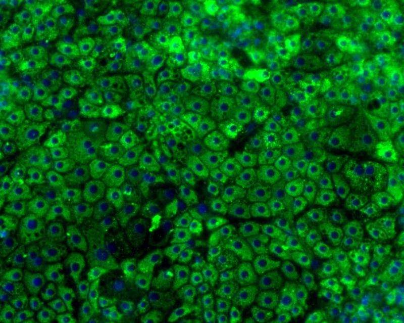 Liver cell therapies closer as study reveals key to mass production