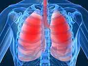 High-value research of 2014 presented for pulmonary med